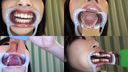 Full HD │ [Tooth fetish] Observe Yua-chan's beautiful teeth and shining silver teeth!