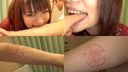Full HD │ [Biting fetish] Tongue long sister Rena-chan's intense pain bite! (Part 1) [Rena Kitamura]