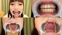 【Tooth fetish】Magnificent teeth hidden in Ayane Suzukawa's cute mouth! 【Ayane Suzukawa】