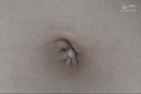 Navel of 100 amateurs 8