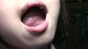 【Oral observation】People with big have long tongue KITR00020