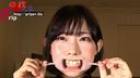 Owner of an oral cavity full of individuality, Mao MochizukiThroat resection during caries treatmentOral appreciation