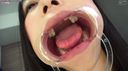 (1) [Tsubabero M man] Observation! The mouth and tubabero of an amateur girl Rion-chan who came out of the countryside of Hokuriku!