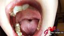 Owner of an oral cavity full of individuality, Mao MochizukiThroat resection during caries treatmentOral appreciation