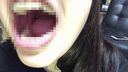 【울트라 레어·매니악용】교정중의 미녀의 「입술, 입, 혀, 치아, 목 아소코」의 클로즈업
