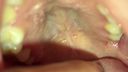 【Gro Caution】Almost like a stomach camera, but actually an image of the inside of the mouth [Ultra Ultra Ultra Super Super Super Viewing Caution] Minor (2) KITR00144