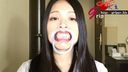 Slender beauty OL Riku Otsuka's silver tooth one oral cavity appreciated with a mouth aperture