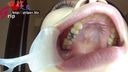Slender beauty OL Riku Otsuka's silver tooth one oral cavity appreciated with a mouth aperture