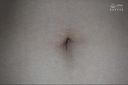 Navel of 100 amateurs 8