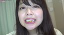 (5) [Tsubabello M man] New project! Brushing the teeth of a former female Anna-chan, mouth viewing, tooth viewing, chewing & chewing in front of subjective eyes!