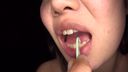 치과 치료 흔적이 많은 어린이의 치아는 무엇입니까? 미사키(6) FETK00520