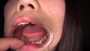 開口器で固定された口内から溢れ続ける唾液蜜 みい④ FETK00539