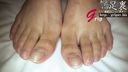 Female college student's blisters have beans on the outside of their chicks and nails firmly 22.5cm sole toe close-up appreciation