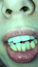 【悲報】清楚な人妻の茶色い歯と黄色い舌苔【閲覧注意】 えま① FETK00641