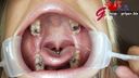 Tongue Pi Long Tongue Gal Sorami 5 Silver Teeth Mouth Aperture Inspection & ASMR Tooth Brushing