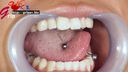 舌ピ長舌ギャルそらみの銀歯5本口腔内を開口器視姦＆ASMR歯みがき