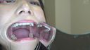 (5) [Tsubabello M man] New project! Brushing the teeth of a former female Anna-chan, mouth viewing, tooth viewing, chewing & chewing in front of subjective eyes!
