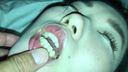 【速報】色素沈着と被せが目立つ歯、舌苔タップリのベロを持つ「美人」 シズカ② KITR00203