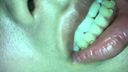 이빨 뒤쪽에 범용 휴머노이드 결정적 무기와 유사한 구속 장치 확인 유이(2) KITR00214