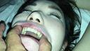 【速報】色素沈着と被せが目立つ歯、舌苔タップリのベロを持つ「美人」 シズカ② KITR00203
