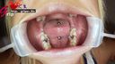 舌ピ長舌ギャルそらみの銀歯5本口腔内を開口器視姦＆ASMR歯みがき