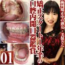 矯正中熟女の美保の歯列矯正スタート1年半の口腔内を開口器鑑賞