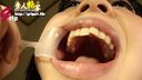 歯フェチ◎素人爆乳OLの恵ちゃんの綺麗な口腔内を開口器装着で鑑賞
