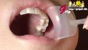 戀牙癖◎家庭主婦香織戴著嘴巴開口欣賞三顆銀牙口腔喉嚨