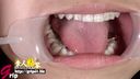 戀牙癖◎家庭主婦香織戴著嘴巴開口欣賞三顆銀牙口腔喉嚨