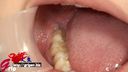 65mm long-tongue Harukawa Sesera's bruxism marks and mouth aperture oral appreciation with rare teeth