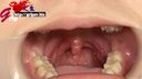 65mm長舌晴川Sesera的磨牙症痕跡和口腔孔口欣賞與稀有牙齒