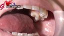 Tongue fetish Oral fetish ◎ Niikura Konomi's long tongue and mouth opening to appreciate intraoral teeth close-up