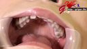 歯フェチ◎素人ハーフ美女アイネの歯を開口器で接写視姦＆歯みがき