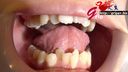 口腔戀物癖◎業餘OL Nano的自然牙齒對齊與嘴巴張開與特寫和刷牙