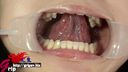 숨겨진 변태 미녀 카구라 아이네의 입 개폐로 구강(충전물 포함) 밀착 검사