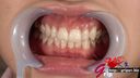 65mm 긴 혀 간호사 카와고에 유이의 치과 의사 프리 구강 감상 입 구멍