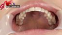 65mm long tongue nurse Yui Kawagoe's dentist-free oral cavity appreciation with a mouth aperture