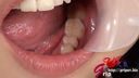 65mm long tongue nurse Yui Kawagoe's dentist-free oral cavity appreciation with a mouth aperture