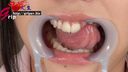 65ミリ大長舌ナース川越ゆいの歯医者いらずな口腔内を開口器で鑑賞