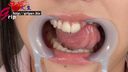 65mm long tongue nurse Yui Kawagoe's dentist-free oral cavity appreciation with a mouth aperture