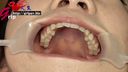 66ミリ長舌巨乳・久我かのんの綺麗な歯がそそる口腔内を開口器で鑑賞