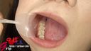 66毫米長舌，卡農庫加美麗的牙齒用孔徑喚起口腔內部