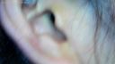 【여체의 수수께끼】내시경 카메라로 미녀의 관찰 (1) "귀 구멍"@素人オリジナル個人撮影