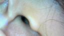 【여체의 수수께끼】내시경 카메라로 미녀의 관찰 (1) "귀 구멍"@素人オリジナル個人撮影