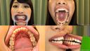 Full Hi-Vision │ [Tooth Fetish] I observed the beautiful natural teeth of Sunochi! 【Mirai Sunohara】