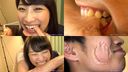 [Bite fetish] Intense pain bite piercing of the sharp canine teeth of the sunochi bite! (Part 1) [Mirai Sunohara]