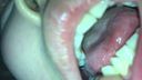 Collaboration between teeth with treatment marks in the mouth of Neccho Necho and thick tongue Ayato(2) KITR00231