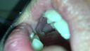 【Super close-up in the mouth】Saliva fountain with maximum humidity Miu (2) KITR00242