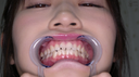 [Mouth / Teeth] Extremely recommended actress Suzaki Miwa Chan's extremely rare teeth mouth observation & drooling electric massage!