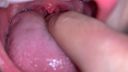 [Personal shooting] When I was observing the back of the throat of a dirty girl who applied for a complete face NG, I cried while dripping violently w Naho [Y-045]